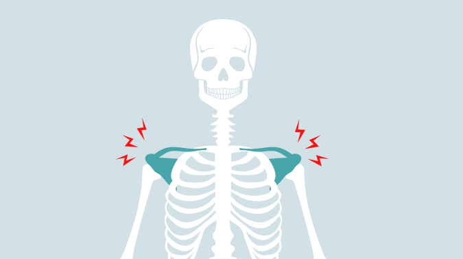 부산회전근개파열