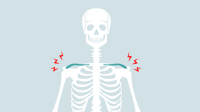 부산어깨충돌증후군