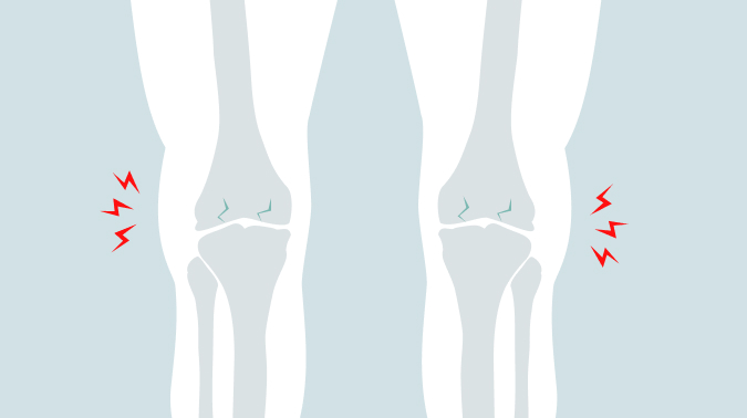 부산퇴행성관절염