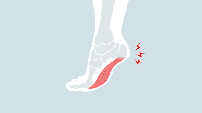 부산족저근막염