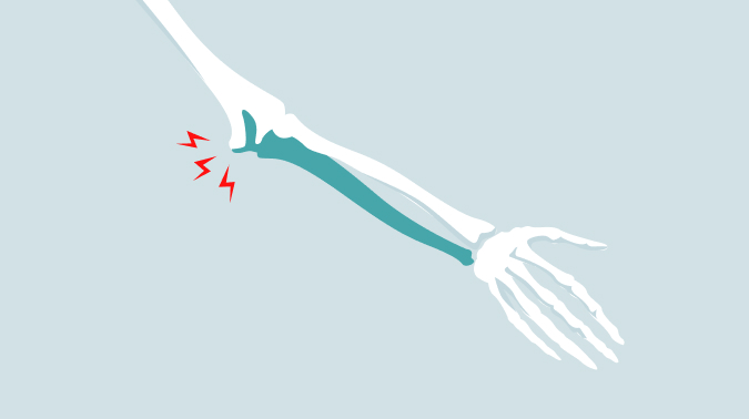 부산골프엘보/부산테니스엘보