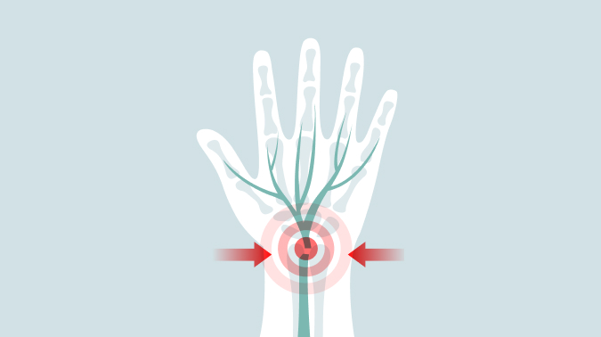부산손목터널증후군